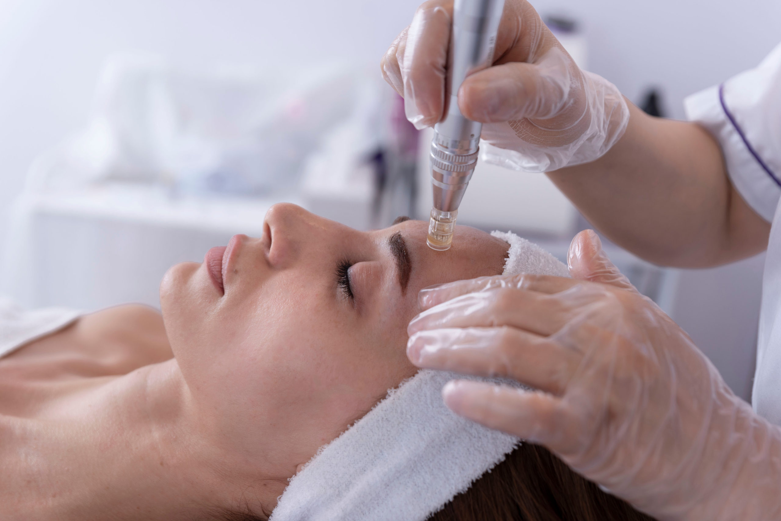 Von Penn Aesthetics Microneedling